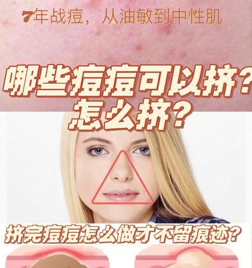 捏痘痘手机壳如何制作？需要哪些材料？